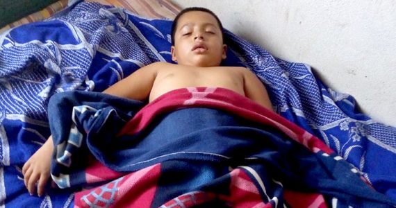 Picture of boy in Guatemala with epilepsy