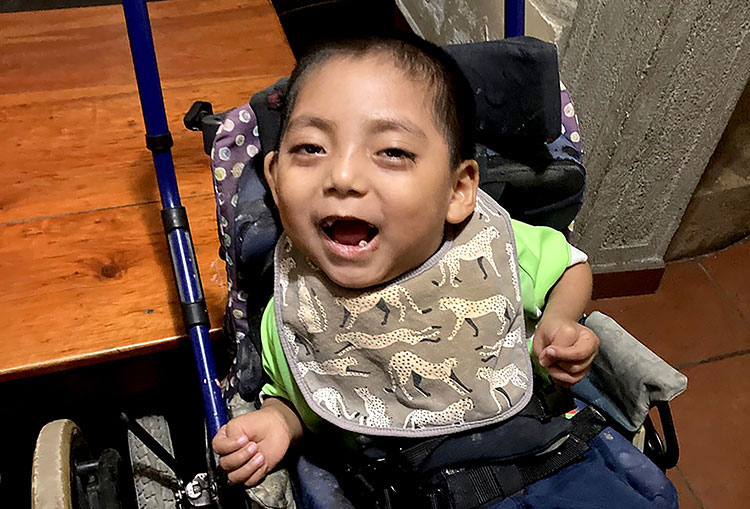 Image of child in Guatemala with medical need smiling